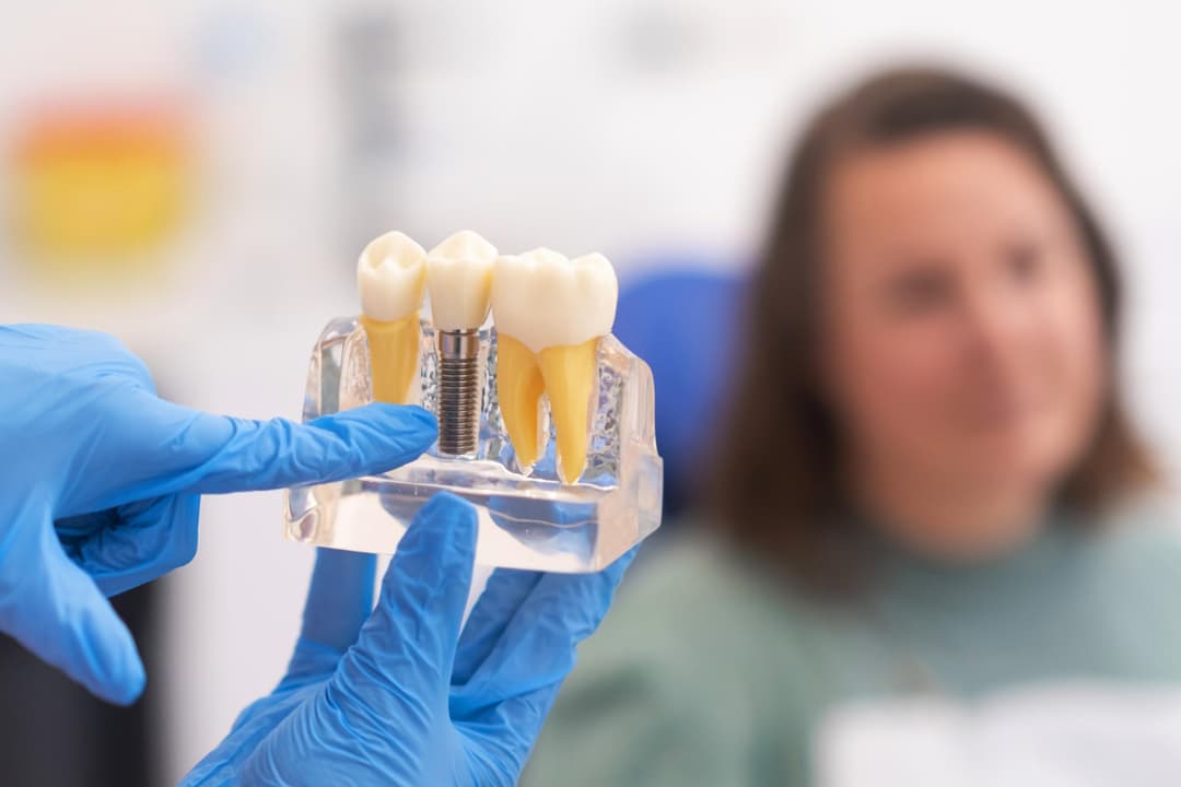 Dental Filling