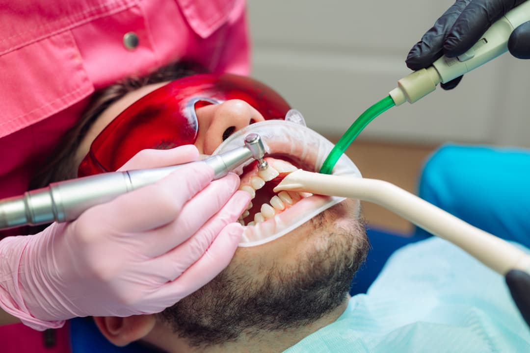 Dental Filling