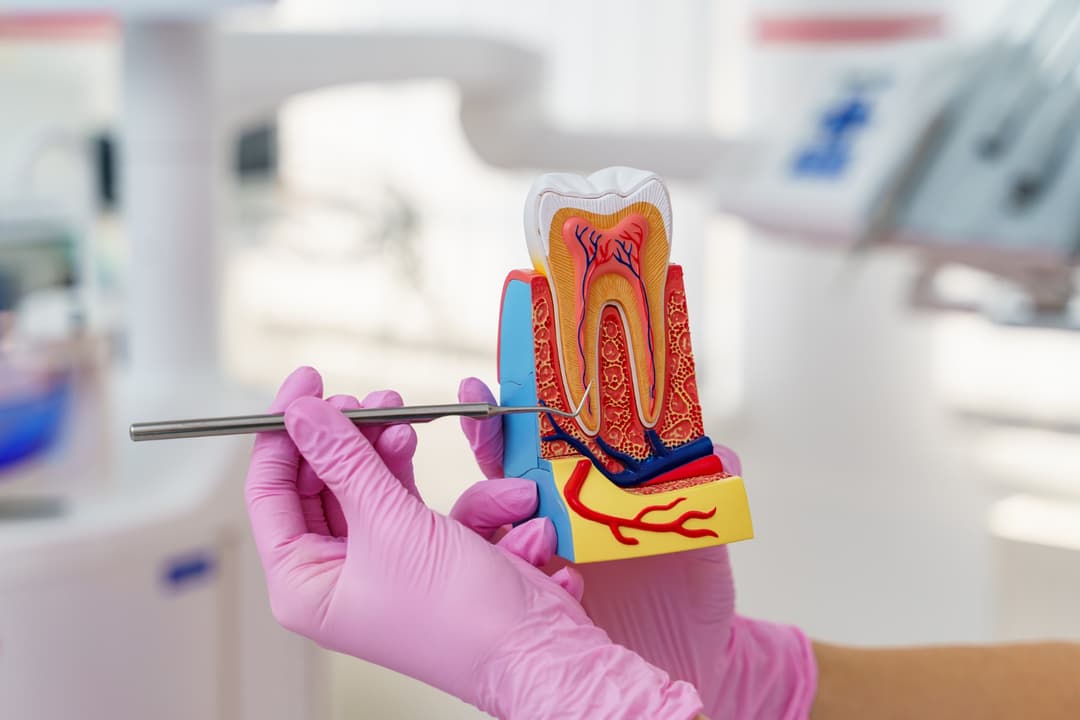 Dental Filling