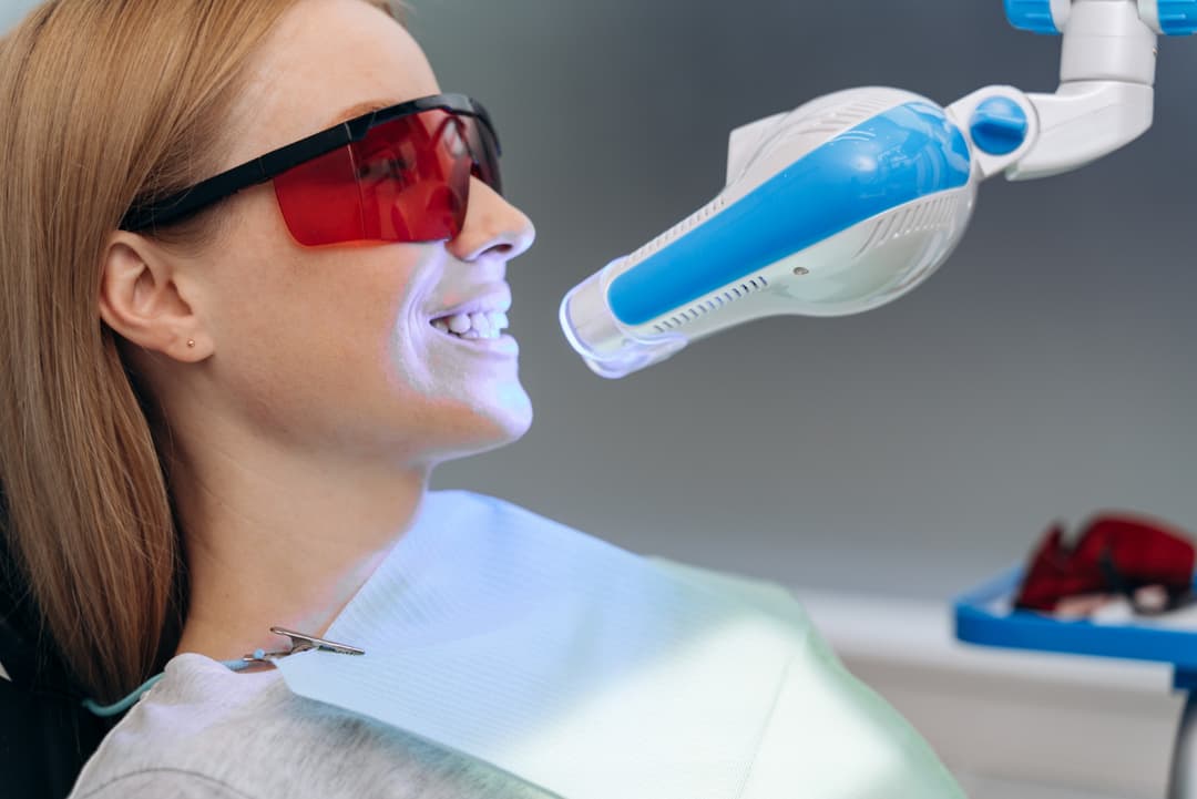 Dental Filling