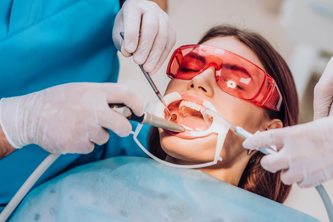 Dental Filling